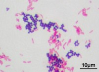 Ποια είναι η διαφορά μεταξύ Gram Stain και Acid Fast 